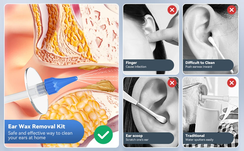 מכשיר שטיפת אוזניים להזרמת מים לאוזן בעדינות לניקוי שעווה ופתיחת סתימות