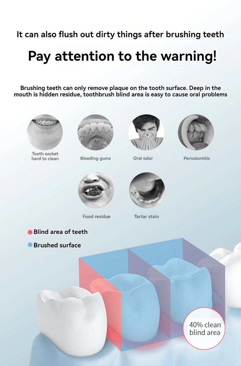 מכשיר שטיפה ידני נייד להסרת פלאק וניקוי בין השיניים ללא פגיעה בחניכיים